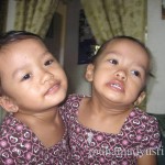 Puteri Kembarku1 150x150 Anak anakku